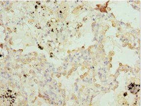 BTG1 antibody