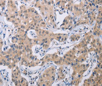 BTG1 Antibody