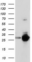 BTK Antibody