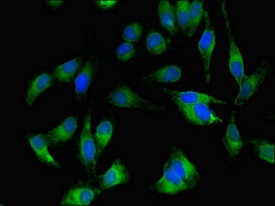 BTK antibody