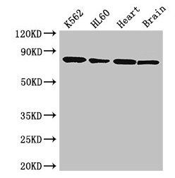 BTK antibody