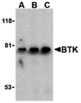 BTK Antibody