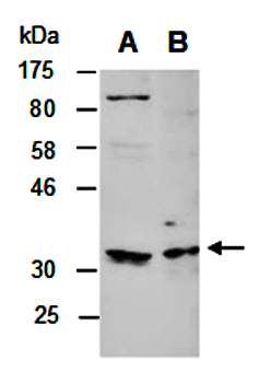 BTLA (N) Antibody, Rabbit Polyclonal