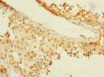BTNL3 Antibody
