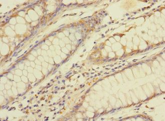 BTNL3 Antibody