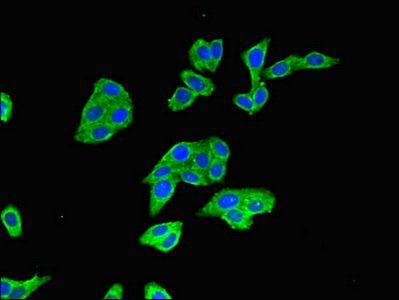 BTRC Antibody