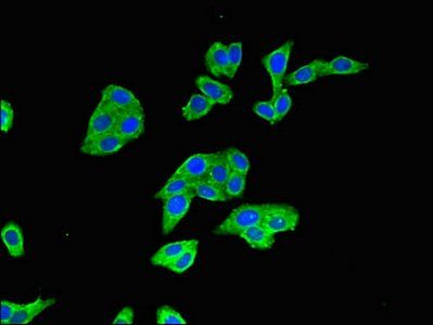 BTRC antibody