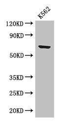 BTRC Antibody