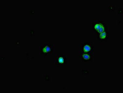 BUB1B antibody