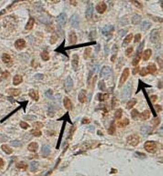 Bub3 Rabbit Polyclonal Antibody
