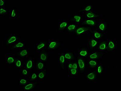 HIST1H2BC Antibody