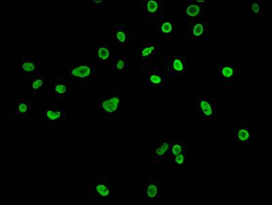 Butyrly-HIST1H3A (K27) Antibody