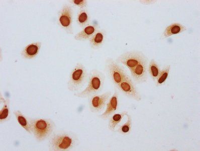 Butyrly-HIST1H3A (K79) Antibody