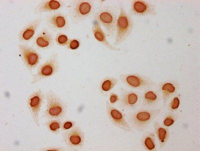 Butyrly-HIST1H3A (K9) Antibody