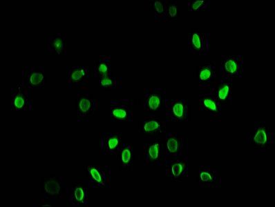 Butyrly-HIST1H3A (K9) Antibody