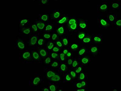 HIST1H4A Antibody