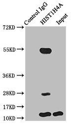 Butyrly-HIST1H4A (K5) antibody