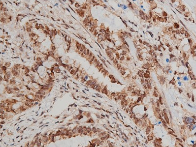 AKT (Phospho-Ser473) antibody