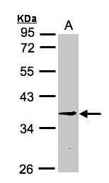 ZC3H8 antibody [N1C3]
