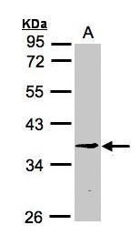 ZC3H8 antibody