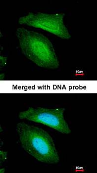 BZW2 antibody