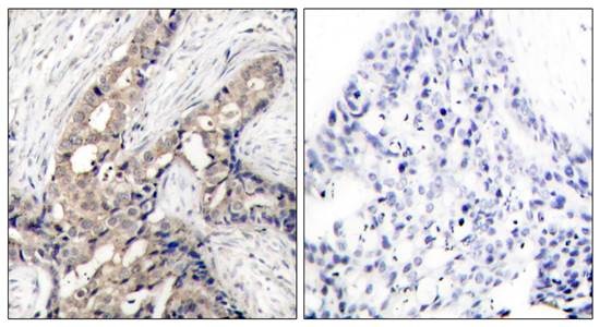 c-Abl(Phospho-Tyr412) Antibody