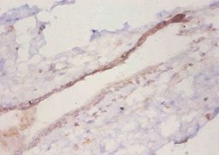 CCL2 Antibody