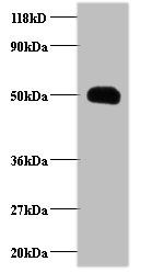 C-C motif chemokine 2 antibody