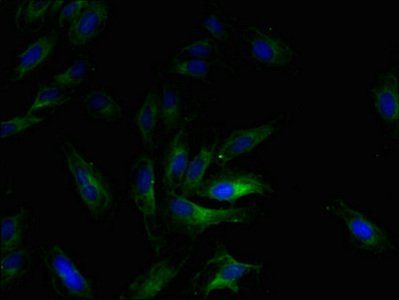 Ccl2 Antibody