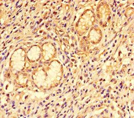 C-C motif chemokine 8 antibody