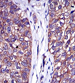 C-CBL Antibody