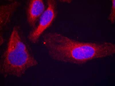 c-Cbl (phospho-Tyr700) Antibody