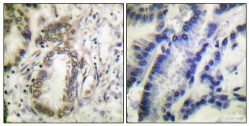 C/EBP-α (Phospho-Ser21) Antibody