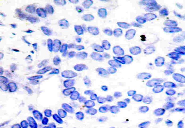 c-Jun (Ab-91) Antibody