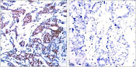 c-Jun (Phospho-Ser73) Antibody