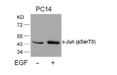 c-Jun (Phospho-Ser73) Antibody
