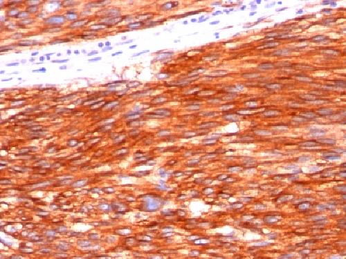 CD117 / c-Kit (Marker for Gastrointestinal Stromal Tumors) Antibody
