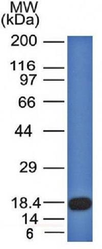 CD117 / c-Kit (Marker for Gastrointestinal Stromal Tumors) Antibody