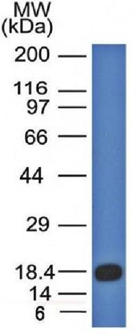 CD117 / c-Kit (Marker for Gastrointestinal Stromal Tumors) Antibody