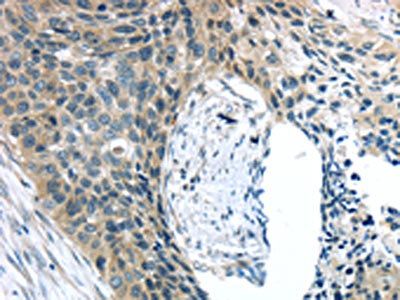 KIT Antibody