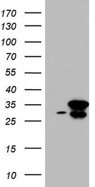 CD117 Antibody