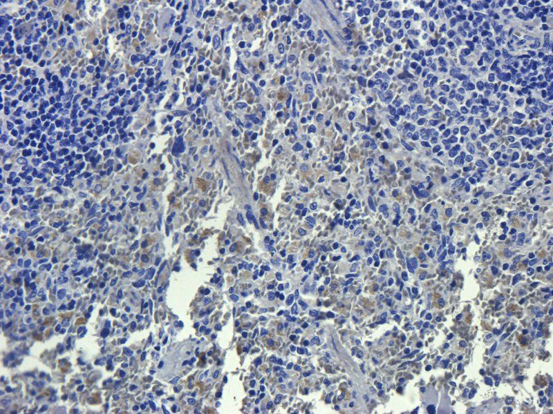 c-Kit antibody