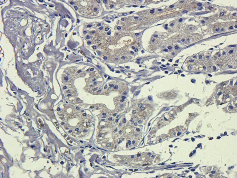 c-Kit antibody