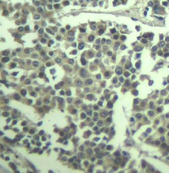 c-kit (phospho-Tyr936) Antibody