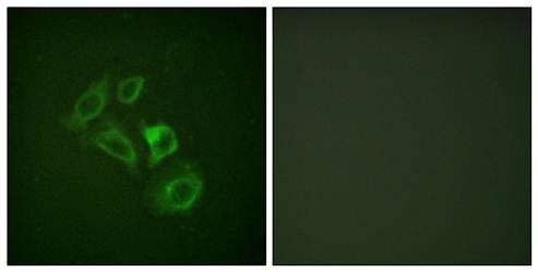 c-Met (Phospho-Tyr1003) Antibody