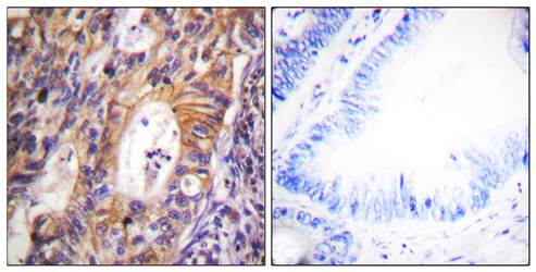 c-Met (Phospho-Tyr1003) Antibody