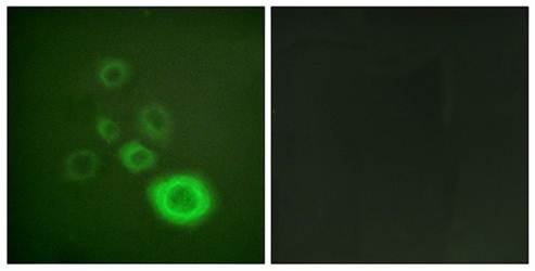 c-Met (Ab-1003) Antibody