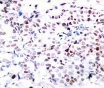 Myc (Phospho-Thr358) Antibody