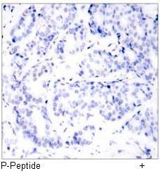Myc (Phospho-Thr58) Antibody