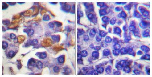 C-RAF (Phospho-Tyr341) Antibody